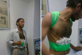 ‘Bomba’  em corpo de candidato da OAB era bala de gengibre