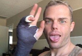 Drag queen de RuPaul diz ter quebrado a mão ao ser atacada por nazista