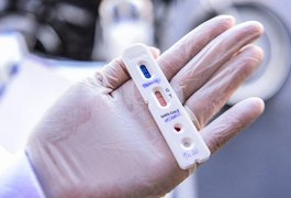 Boletim da Covid-19 em Arapiraca: 102 novos casos e um óbito
