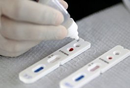 Estudo observa que anticorpos em pacientes recuperados de Covid-19 diminuíram rapidamente