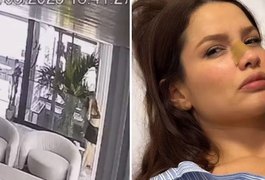 Juliette sofre acidente doméstico e fratura o nariz