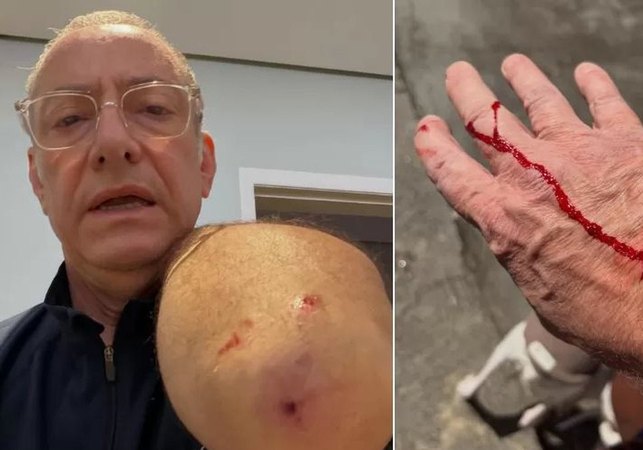 Jornalista da Globo é atacado por pitbull sem guia