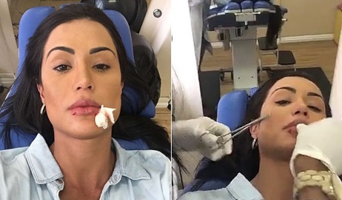 Brincadeirinha! Gracyanne Barbosa é mordida por cão de estimação