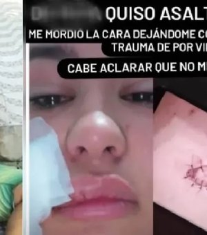 Justiça torna réu jovem que mordeu rosto de turista paraguaia durante tentativa de assalto