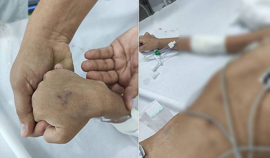 Morre no hospital a menina de 5 anos que teria sido espancada por pai e madrasta em São Miguel dos Campos