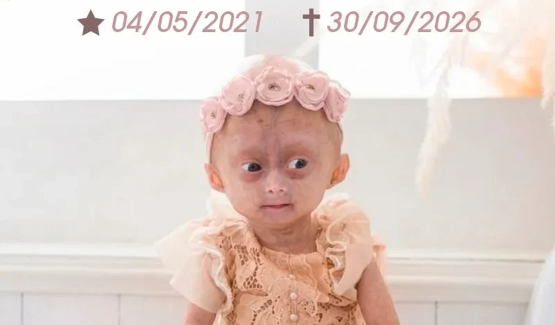 Influencer mirim com ﻿síndrome rara, Elis Lima Carneiro morre aos 5 anos