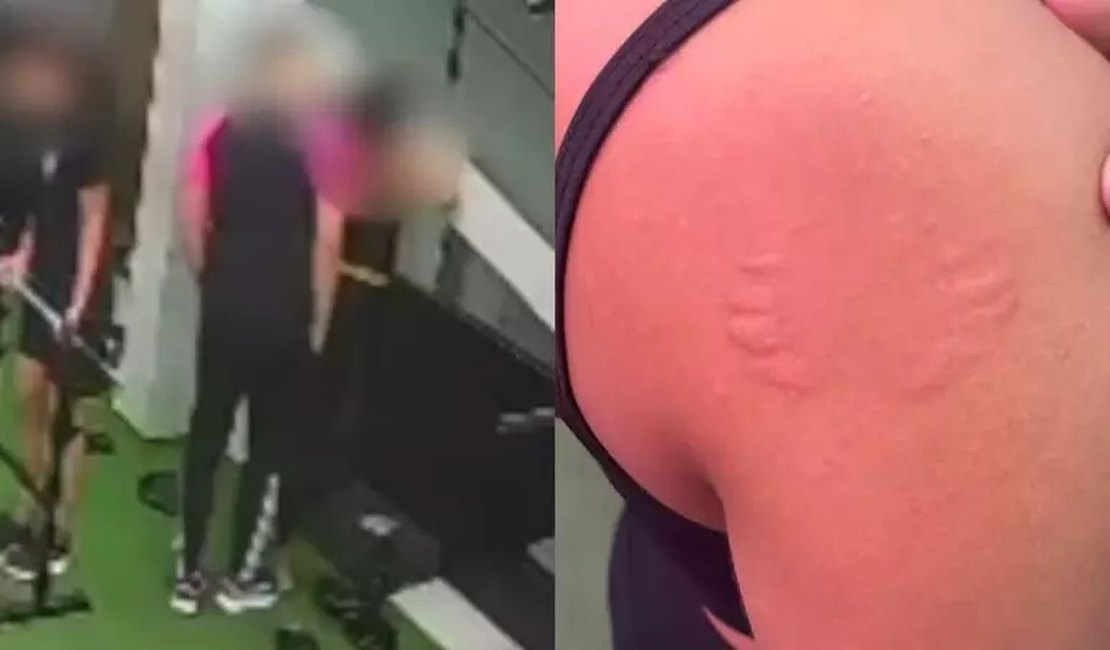 Mulher denuncia assédio após ser mordida e agarrada por instrutor de academia em Pernambuco