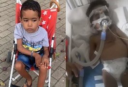 Mãe de menino de Taquarana com atrofia muscular precisa de ajuda para comprar suporte ventilatório