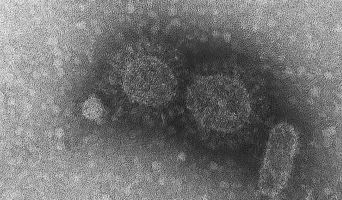 Variante do coronavírus identificada no interior já circulava desde janeiro em São Paulo