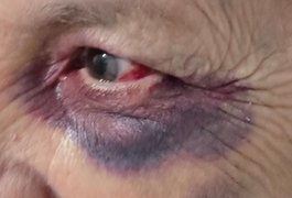 Polícia Civil prende dois homens por violência doméstica em Palmeira dos Índios
