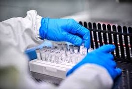 Com mais 25 casos confirmados, Arapiraca registra 10.424 infectados