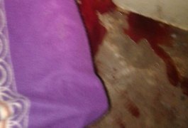 Homem é assassinado a tiros na zona rural de Feira Grande