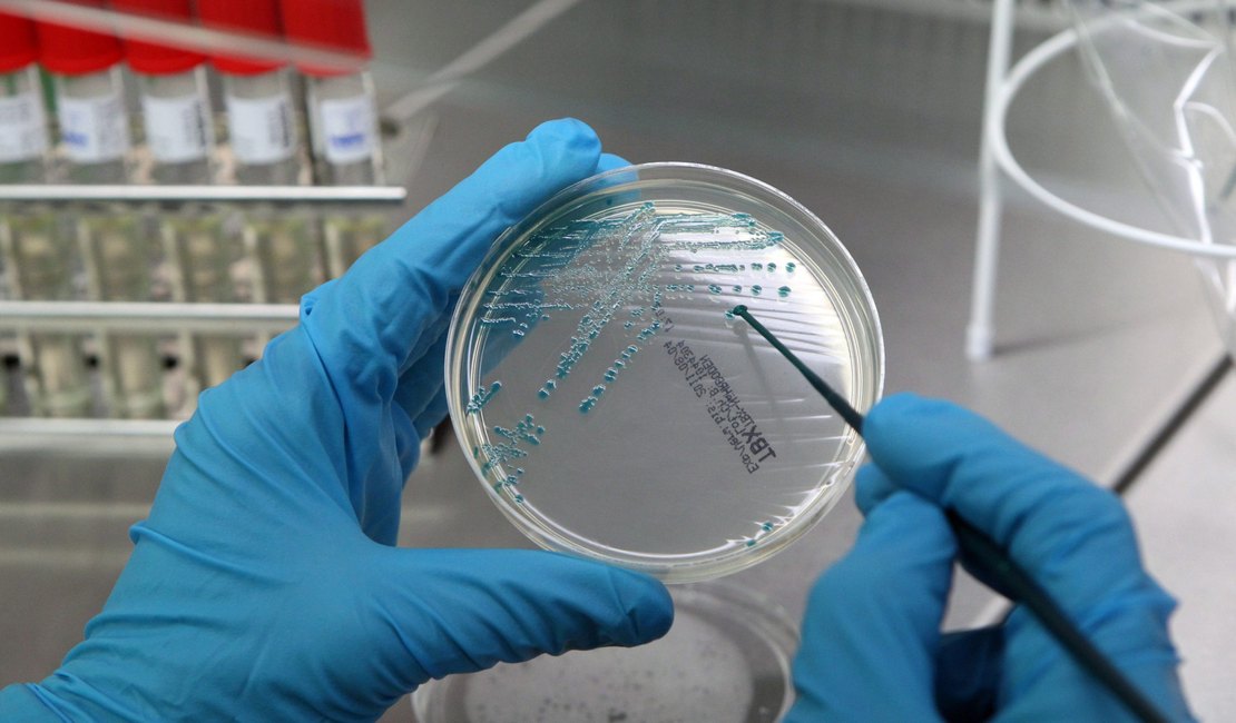 Identificada proteína com possíveis implicações na demência