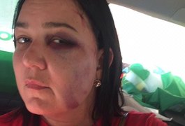 Mulher é agredida por grupo após declarar voto a candidato