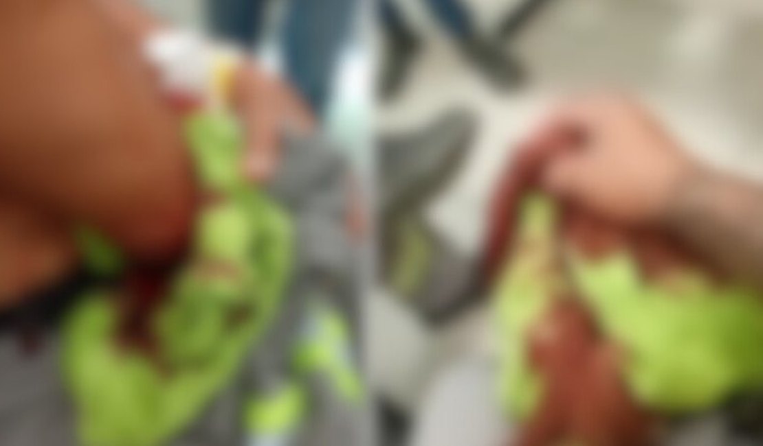 Funcionários da BRK são atacados com facão durante serviço em Atalaia