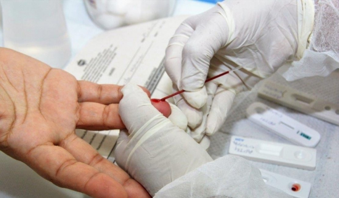 Maioria dos casos notificados de HIV em Maceió é de pessoas de 20 a 34 anos