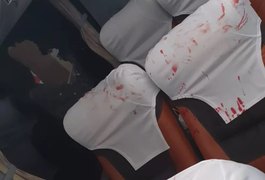 Ônibus do Bahia é atingido por bomba na Fonte Nova, antes de jogo pela Copa do Nordeste