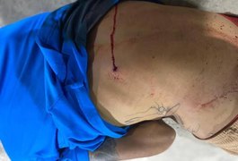 Jovem de 19 anos sofre tentativa de homicídio, em Lagoa da Canoa