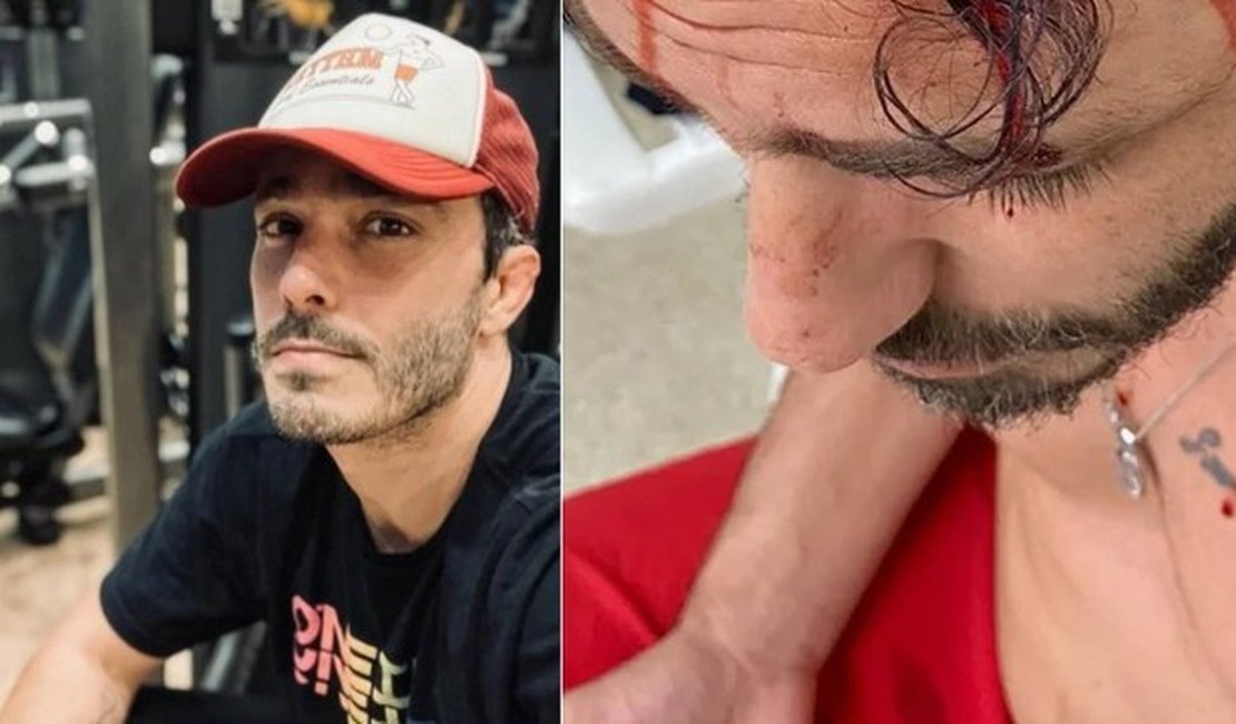 Após ser espancado em assalto, Thiago Rodrigues passa bem e está em casa