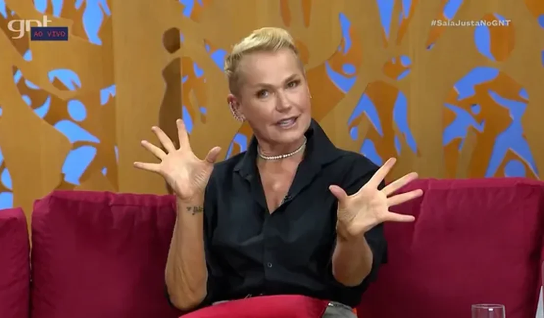 Xuxa revela transplante capilar para tratar alopecia androgenética: entenda o procedimento