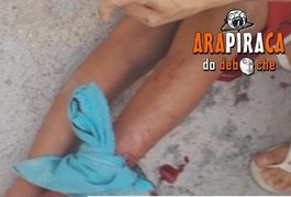 Criança é atacada por jacaré na Ladeira do Claudionor, em Arapiraca