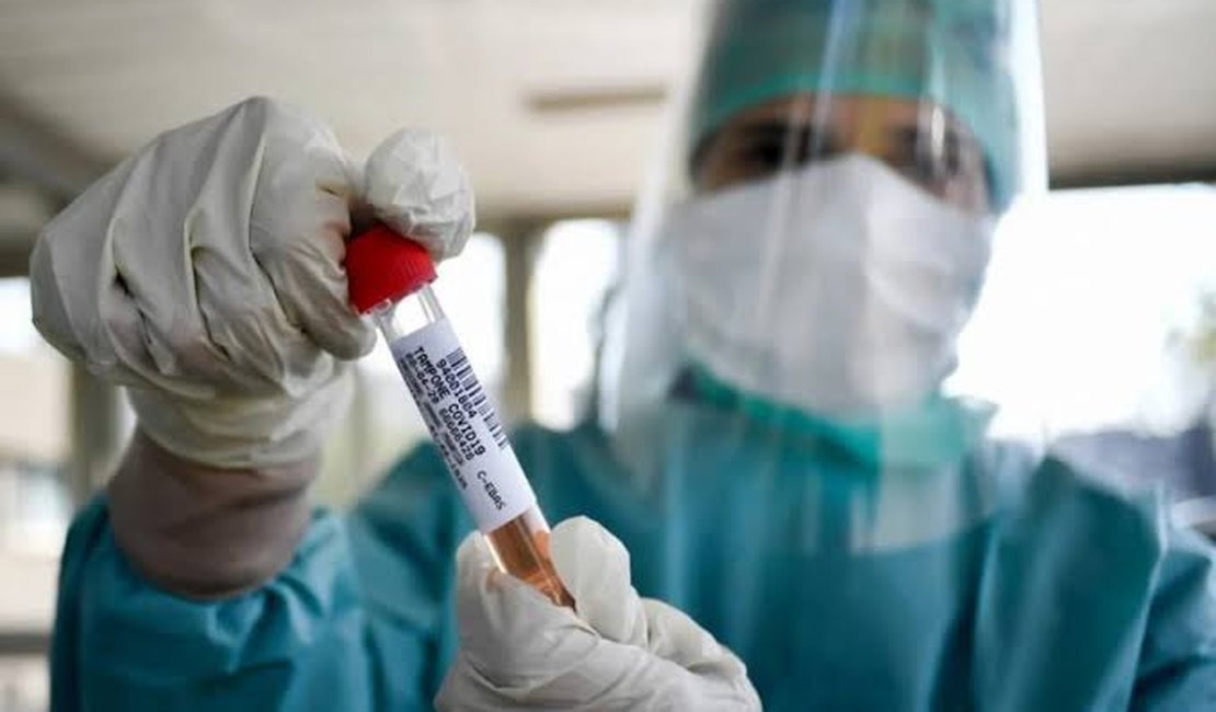 Alagoas registra o 80º óbito e tem mais de 1.600 infectados pela Covid-19