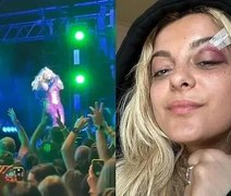 Cantora Bebe Rexha é atingida por celular durante show
