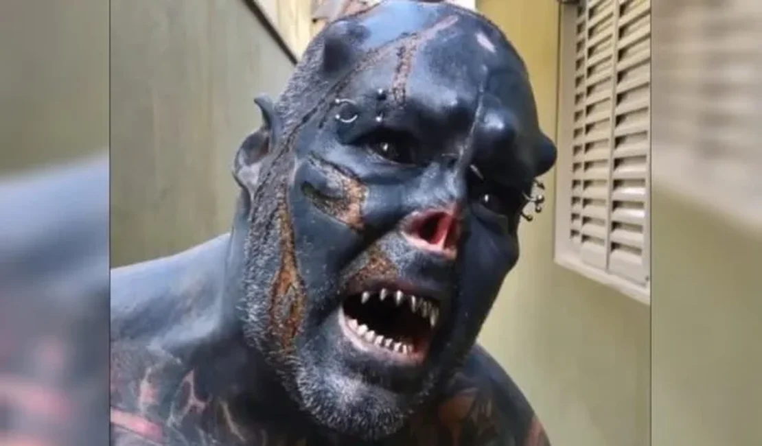 Após mutilar o nariz e a orelha, colocar presas de vampiro e 'chifres', homem decide queimar o rosto: 'Lindo'