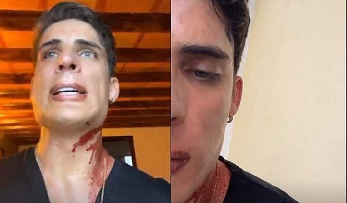 Tiago Ramos, namorado da mãe de Neymar foi esfaqueado em restaurante