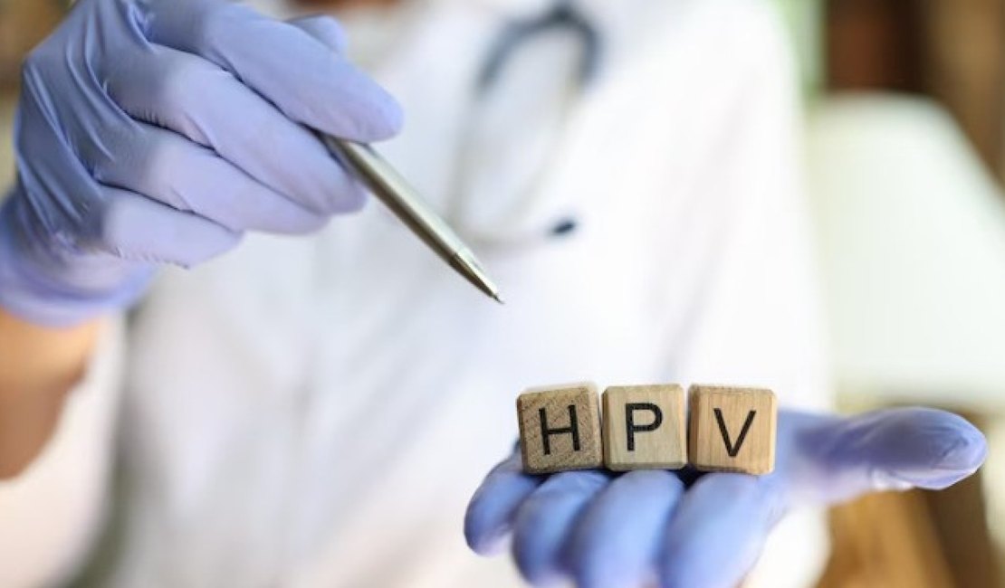 HPV afeta 10 milhões de brasileiros e pode causar vários tipos de câncer