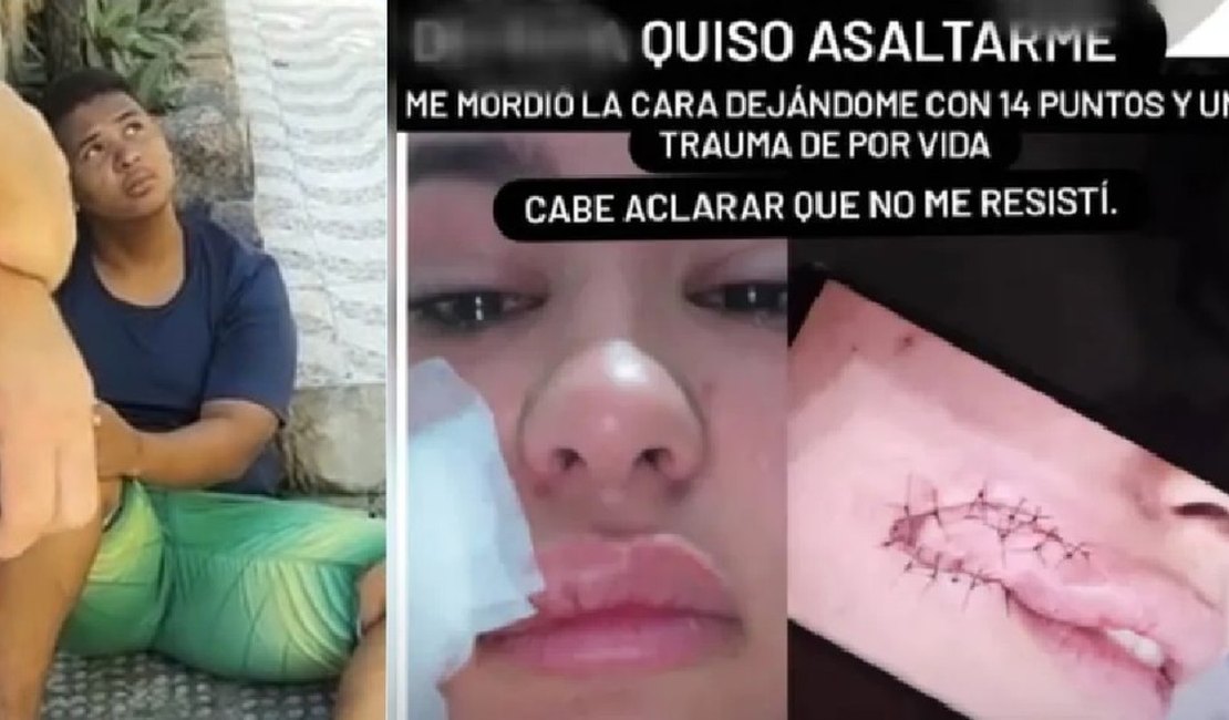 Justiça condena ladrão que mordeu rosto de turista paraguaia em Maceió