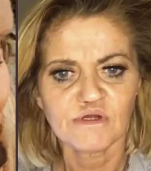 Consumo excessivo de cocaína corrói o rosto de atriz, que choca seguidores após cirurgias