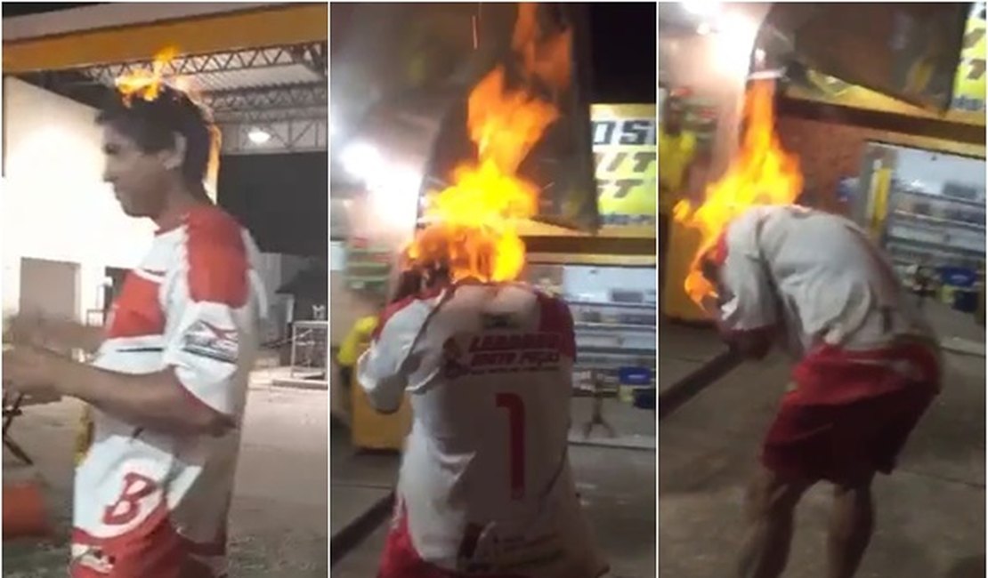 Vídeo. Homem ateia fogo na própria cabeça dizendo que seria para matar o Coronavírus