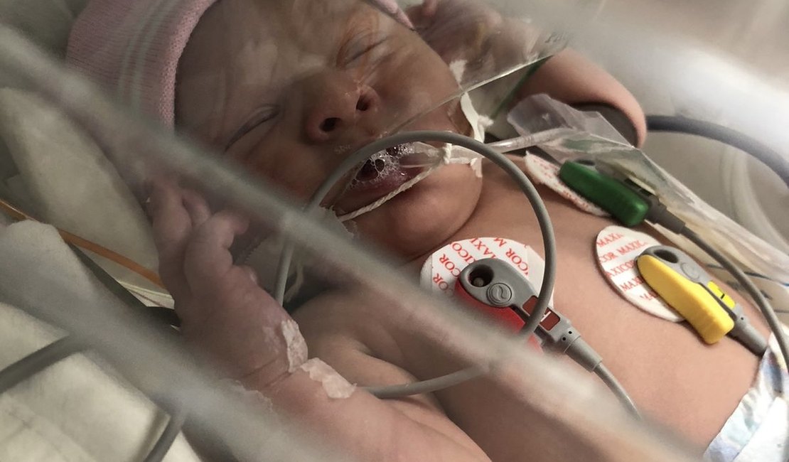 Bebê arapiraquense com apenas 3 dias de vida luta pra sobreviver e família pede ajuda para custos