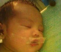 Recém-nascido tem boca lacrada com fita adesiva por chorar alto