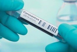 Boletim covid-19: Alagoas soma 20.887 casos confirmados e 723 mortes