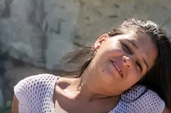 Morre mulher que teve mais de 90% do corpo queimado pelo ex-companheiro em Maceió