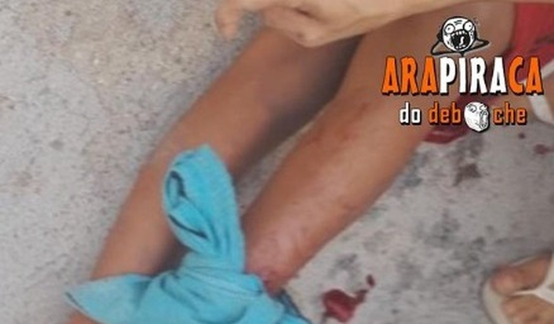 Criança é atacada por jacaré na Ladeira do Claudionor, em Arapiraca