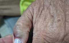 Idosa foi agredida por sobrinha que é médica, em Arapiraca