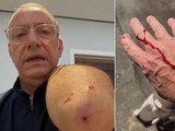Jornalista da Globo é atacado por pitbull sem guia