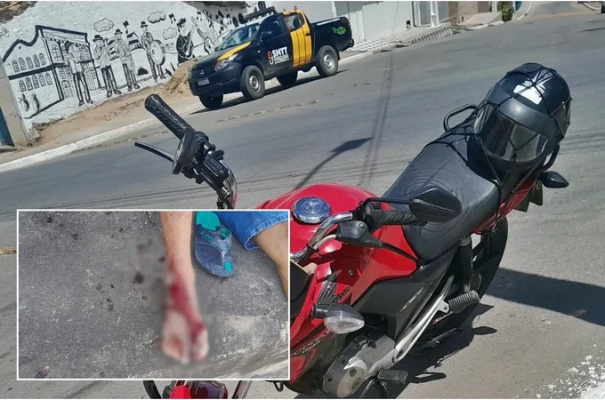 Motociclista com sinais de embriaguez tem o pé mutilado após acidente em São Miguel dos Campos