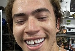 Whindersson Nunes arrebenta dente da frente durante treino e compartilha: 'Vacilei'