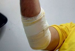 Agente da SMTT de Maceió é atropelado por motociclista durante perícia