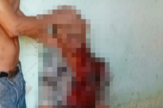 Homem é morto com golpe na garganta após desentendimento com vizinho em Craíbas