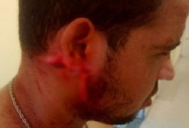 Jovem perde parte da orelha após ser atingido por golpe de facão, no Sertão
