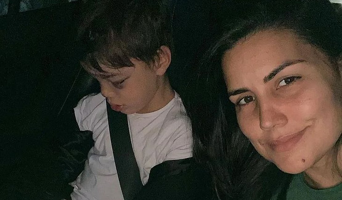 Filho da ex-BBB sofre 3 fraturas em acidente doméstico