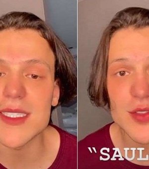 Internautas apontam harmonização facial de Saulo Poncio e cantor vira meme na internet