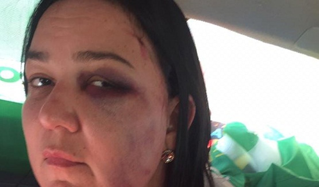 Mulher é agredida por grupo após declarar voto a candidato