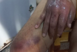 Belo Monte: Mulher é presa por omissão de socorro e maus-tratos contra o próprio pai, de 84 anos