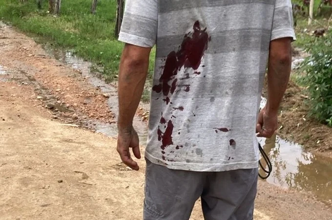 Homem é esfaqueado nas costas após discussão, na zona rural de Palmeira dos Índios